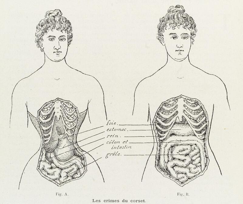 Items · Corsets and Crinolines: A Brief History of Women's Underpinnings ·